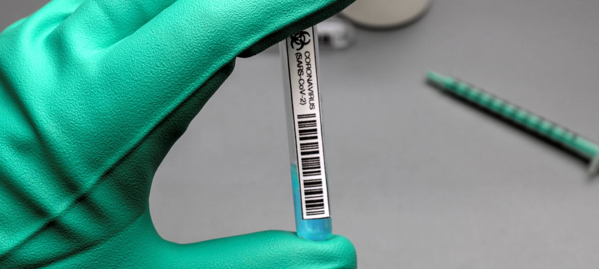 SCHAPDETTEN: Letzter Tag für Testzentrum