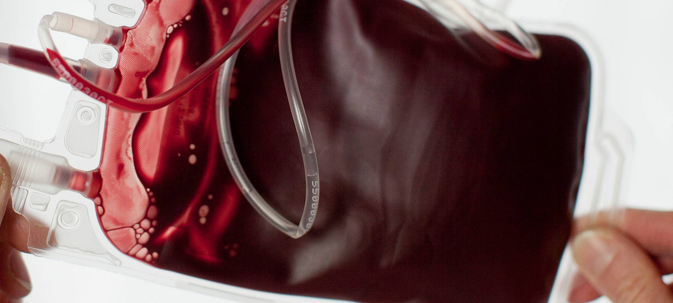 KREIS: Weniger Blutspenden auch wegen Pandemie-Ängsten