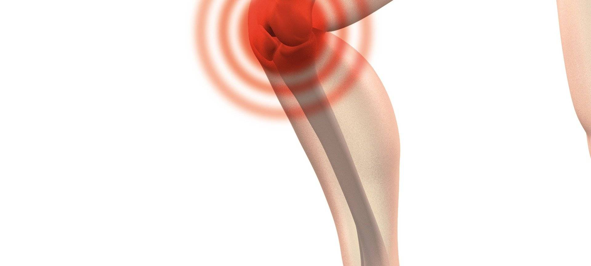 Ihr Thema im Radio: Vortrag zum Thema Arthrose