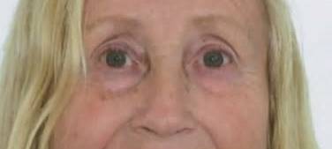 WELTE: Vermisste Frau gesucht