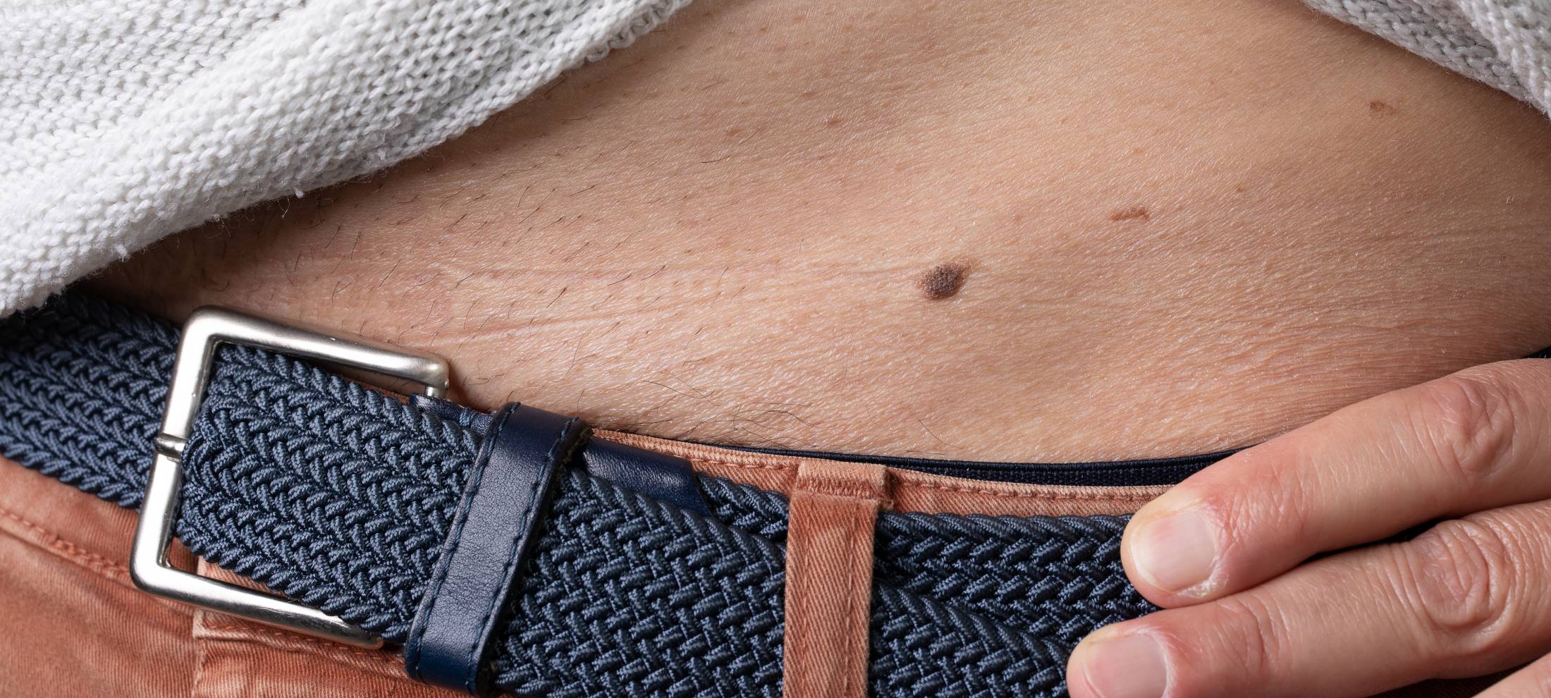 KREIS: Hautkrebsscreening zu unbekannt